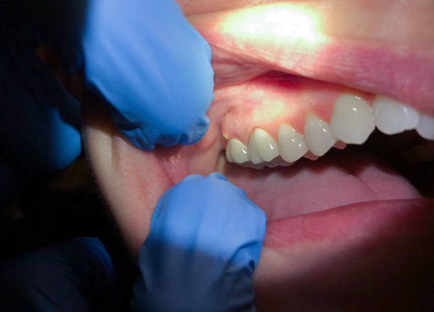 Best Cosmetic Emergency Dentistry in Glenwood, GA